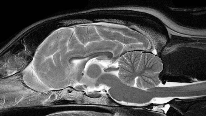 MRI Görüntüleme Artık Rutin