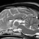 MRI Görüntüleme Artık Rutin