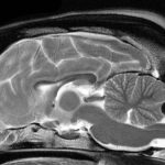 MRI Görüntüleme Artık Rutin MRI Görüntüleme Artık Rutin